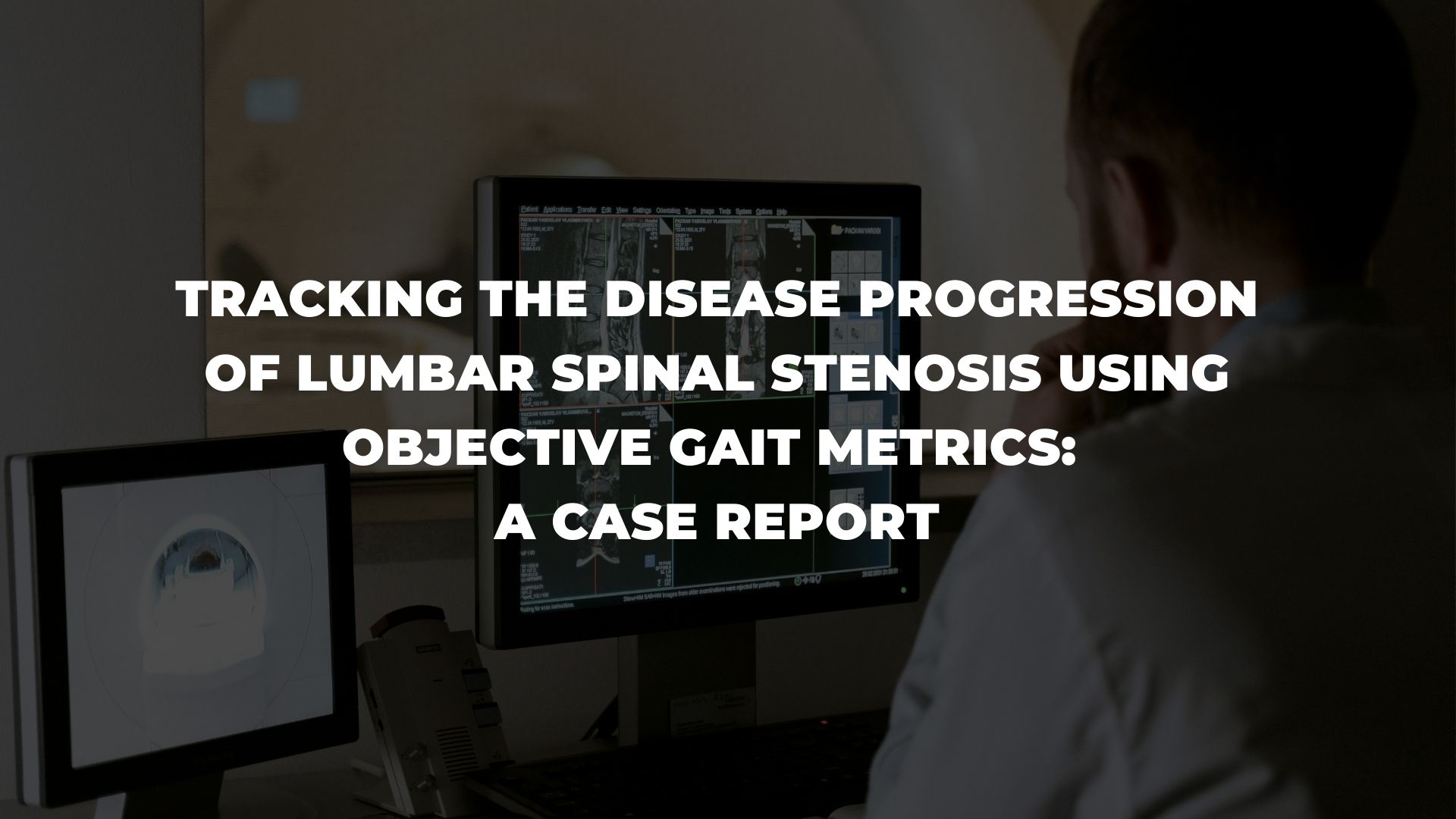 Tracking the disease progression of lumbar spinal stenosis using ...